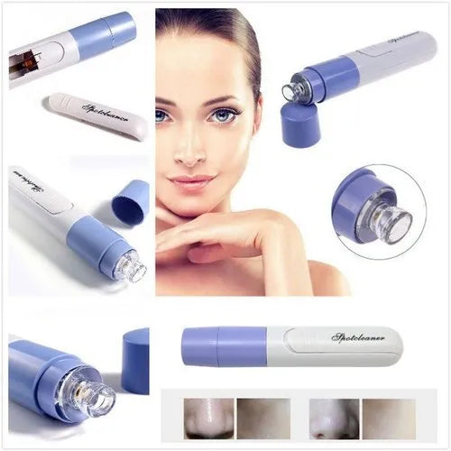 Facial Pore Cleaner
